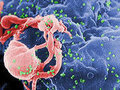 ВИЧ и СПИД: в чем большая разница?