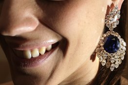 Восстанавливаем прекрасную улыбку. 8125z.jpg