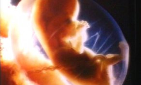 Репродуктивные технологии в России: конец проблемы бесплодия?. 8718z.jpg Репродуктивные технологии в России: конец проблемы бесплодия?. 8718z.jpg