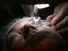 Микрохирургия против катаракты, или Закат 